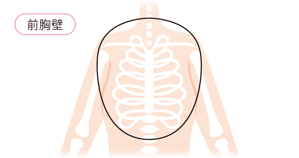 イラスト：上半身における前胸壁の範囲のイメージ