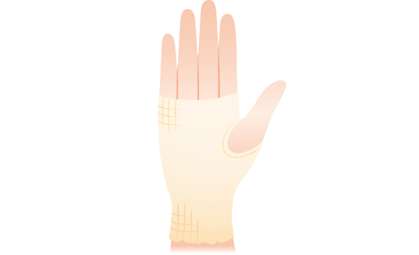 イラスト：チューブ型の包帯を装着した手のイメージ