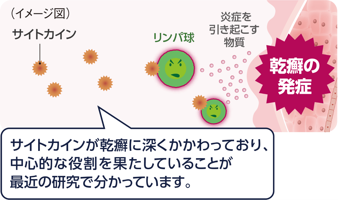 乾癬が起こる仕組みのイメージ図。サイトカインが乾癬に深くかかわっており、中心的な役割を果たしていることが最近の研究で分かっています。