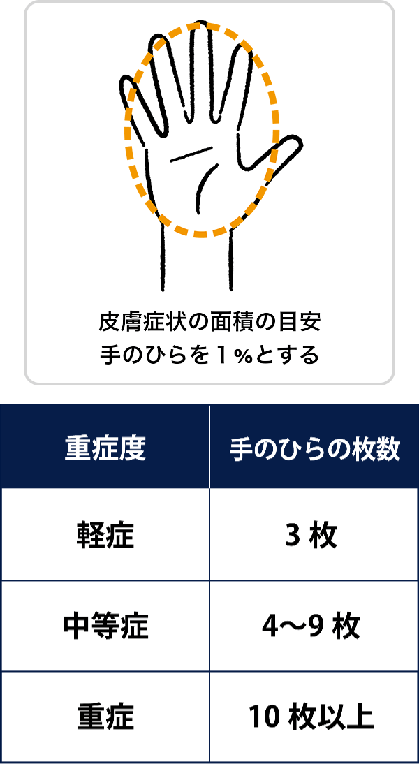 BSAと重症度の相関表。手のひら1枚分の面積を体表面積の1%とし、乾癬面積が手のひら3枚以下の場合は軽症、4枚〜9枚の場合は中等症、10枚以上の場合は重症とする